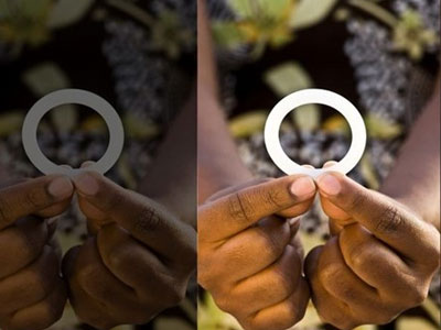 Phụ nữ đặt vòng phòng tránh lây nhiễm HIV/AIDS