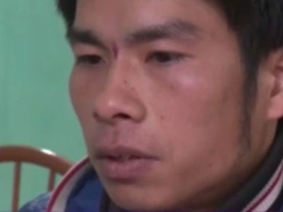 Chồng chém vợ đứt xương: “Đàn bà không đàng hoàng mới đi làm”