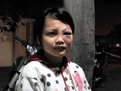 Dùng mũ bảo hiểm đánh vào mặt bé gái vì nghi trộm tiền