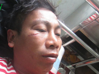 Bị chê, bí thư thôn lao vào đánh dân ngay giữa cuộc họp