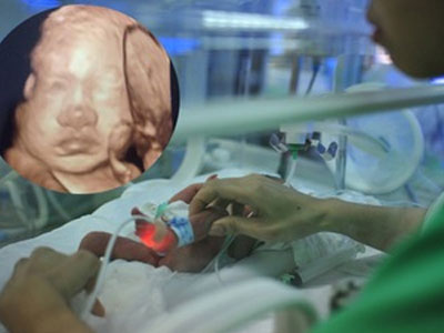Vụ mang thai giả ở BV Phụ sản TƯ: Người phụ nữ đã "dưỡng thai" ở hành lang BV nhiều ngày