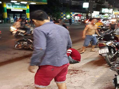 Bắt hai nghi can vụ chém đứt lìa bàn tay