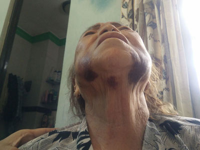 Bà mẹ 85 tuổi nhờ công an xử lý con trai vì bị đánh đập, dọa giết