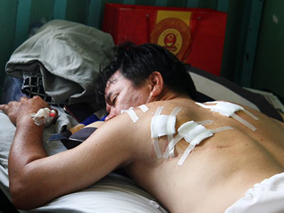Ông chủ nhà hàng bị 2 kẻ lạ tấn công khi đang tính tiền