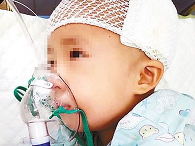 Đau lòng bé gái 3 tuổi bị chấn thương sọ não do ngồi xe đẩy đi siêu thị