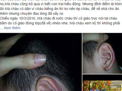 Ăn chậm, bé 4 tuổi bị cô giáo mầm mon nhéo tím tai, quăng ra sàn