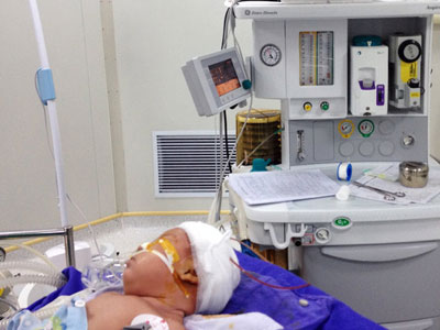 Bé 35 ngày tuổi bị dao quắm xuyên trán
