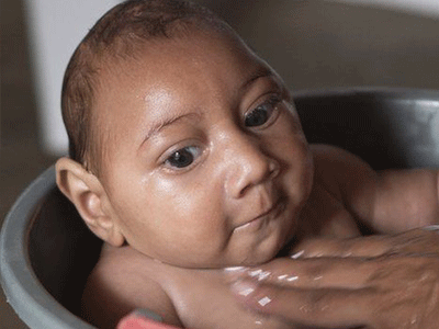 Du khách Australia nhiễm virus Zika sau khi trở về từ Việt Nam