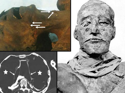 Hé lộ vụ ám sát dã man vua pharaoh Ai Cập