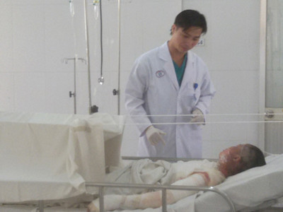 Người vợ bị chồng đốt vì lấy tiền trả nợ mua đồ ăn cho con qua đời