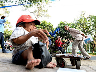 Anh em sọ dừa bán vé số ở Sài Gòn