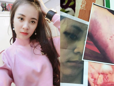 Những uẩn khúc trong vụ cô gái xinh đẹp tung ảnh tố chồng cũ bạo hành