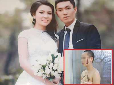 Cô gái mang hình xăm con rết thế nào sau 5 năm?