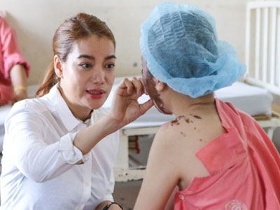 Trương Ngọc Ánh giúp nữ sinh bị tạt axit khôi phục dung nhan