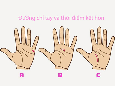 Đường chỉ tay cho biết bạn kết hôn sớm hay muộn