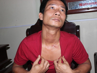 Nghẹt thở giải cứu con tin: "Tôi không nghĩ mình có thể sống sót"