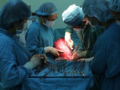 Cắt bỏ khối u “khủng” vượt mặt nặng 7,8kg