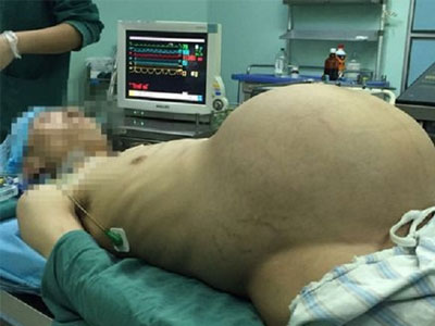 Sự thật không tưởng về người đàn ông "mang bầu" 12 năm