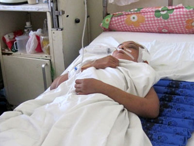 Nửa đêm đánh vợ chấn thương sọ não, hôn mê sâu