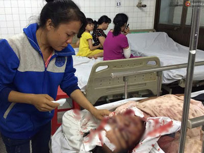 Tranh giành mua đầu trâu, người đàn ông bị đánh hội đồng chấn thương sọ não