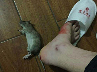 Lại thêm một khách sạn gây sốc vì chuột cắn chảy máu chân khách