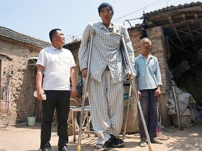 Chàng trai cao 2,4 m ở TQ vẫn tiếp tục phát triển