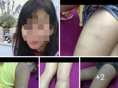 Bắc Ninh: Giáo viên chủ nhiệm đánh học sinh dã man?