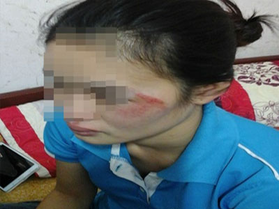Va chạm giao thông, thai phụ bị gã trai hành hung giữa phố