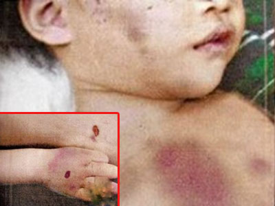Nghi án bé 2 tuổi bị người giúp việc đánh tử vong vì không chịu ăn