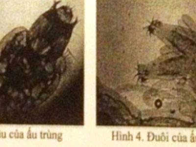 Ấu trùng ruồi la liệt trong nước sạch ở Ninh Bình