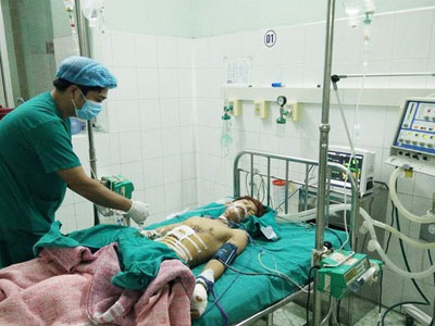 Nổ đèn pin Trung Quốc, thiếu niên thủng bụng, mất 2 ngón tay