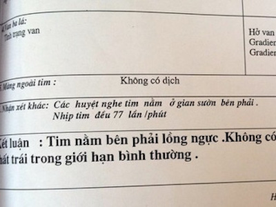 Ảnh bìa bài viết 364639