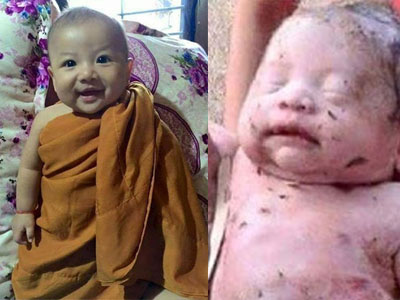 Sự hồi phục kỳ diệu của cậu bé người Thái Lan từng bị đâm 14 lần và chôn sống