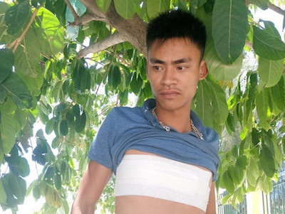 "Đập phá, đánh chủ xe giường nằm gãy xương sườn": Công an lấy lời khai hành khách