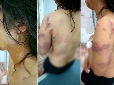 Lộ tin nhắn khiến cô giáo bị chồng cũ đánh bầm tím khắp cơ thể