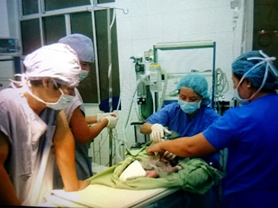 Cứu nhanh, kịp thời trẻ sơ sinh lòi ruột ngoài bụng
