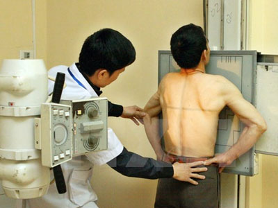 Rà soát các máy X-quang do nguy cơ ảnh hưởng sức khỏe