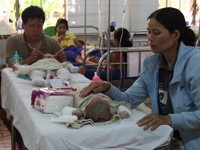 Chồng đổ xăng thiêu vợ, 5 người trong gia đình gặp nạn