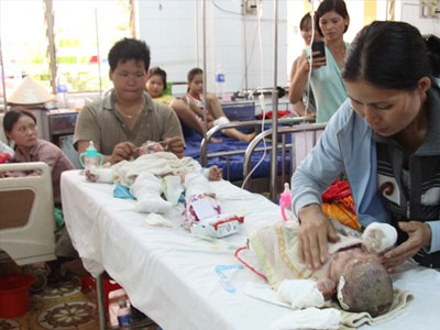 Hai bé bỏng xăng trong vụ cả nhà bị đốt đang nguy kịch