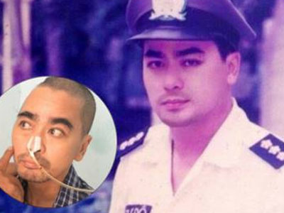 Nguyễn Hoàng lên bàn mổ ghép hộp sọ