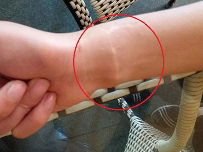 Nữ sinh viên tố bị bạn trai cưỡng hiếp, bóp cổ và dùng dao lam cắt tay bắt phải chết