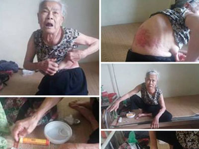 Hà Nội: Mẹ già 81 tuổi tố bị con trai út đánh gãy xương sườn, đuổi khỏi nhà