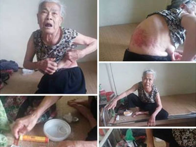 Vụ mẹ già 81 tuổi tố con trai đánh đập đuổi khỏi nhà: Không phải con đánh mà do mẹ vu vạ?