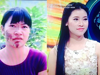 Cô gái dân tộc Sán Dìu xinh đẹp sau 3 tháng dao kéo