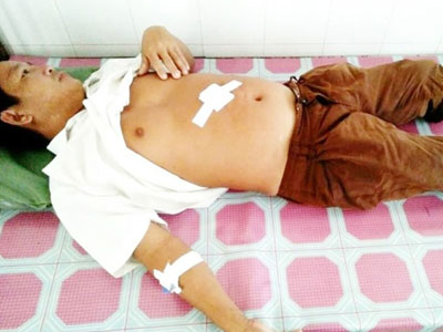 Bị đâm trọng thương khi ngăn côn đồ chém hàng xóm