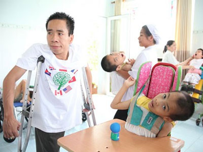 Ba lần tách cặp song sinh dính liền đáng nhớ của bác sĩ Việt