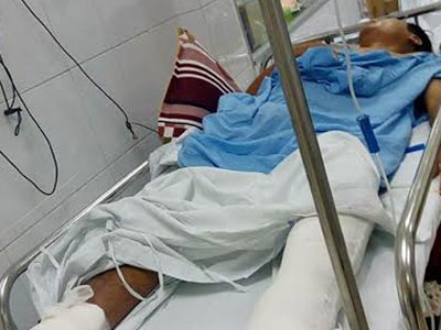 Mổ nhầm chân: Bác sĩ nhận lỗi vì không xem bệnh án