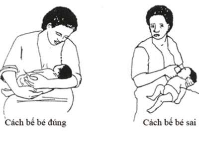 Tư thế đúng và sai khi cho trẻ bú