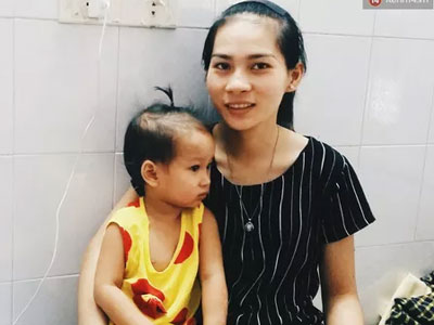 Sức khỏe cháu bé bị cả nồi canh dội vào người đang tiến triển tốt