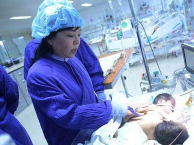 Bố mẹ cặp song sinh dính liền muốn mang gà cảm ơn Bộ trưởng Y tế
